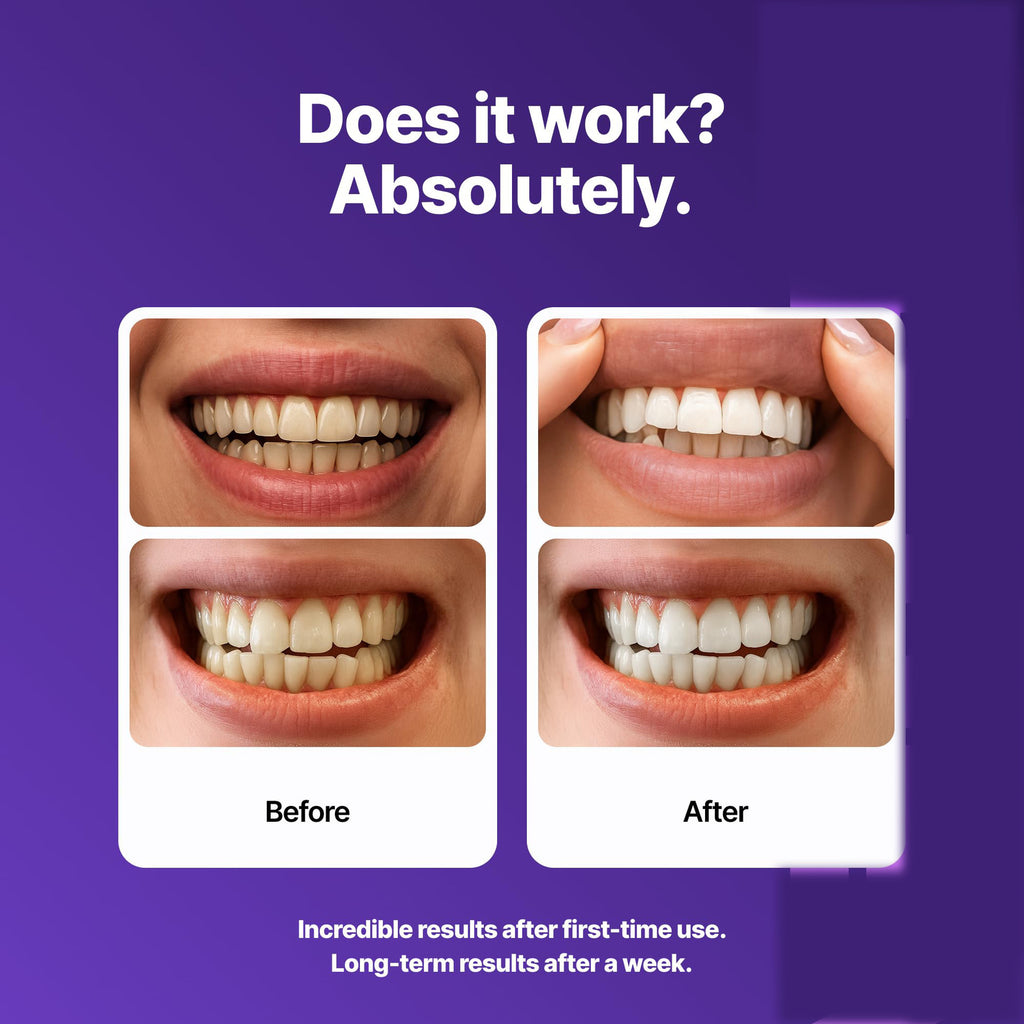 Purple Teeth Whitening Strips