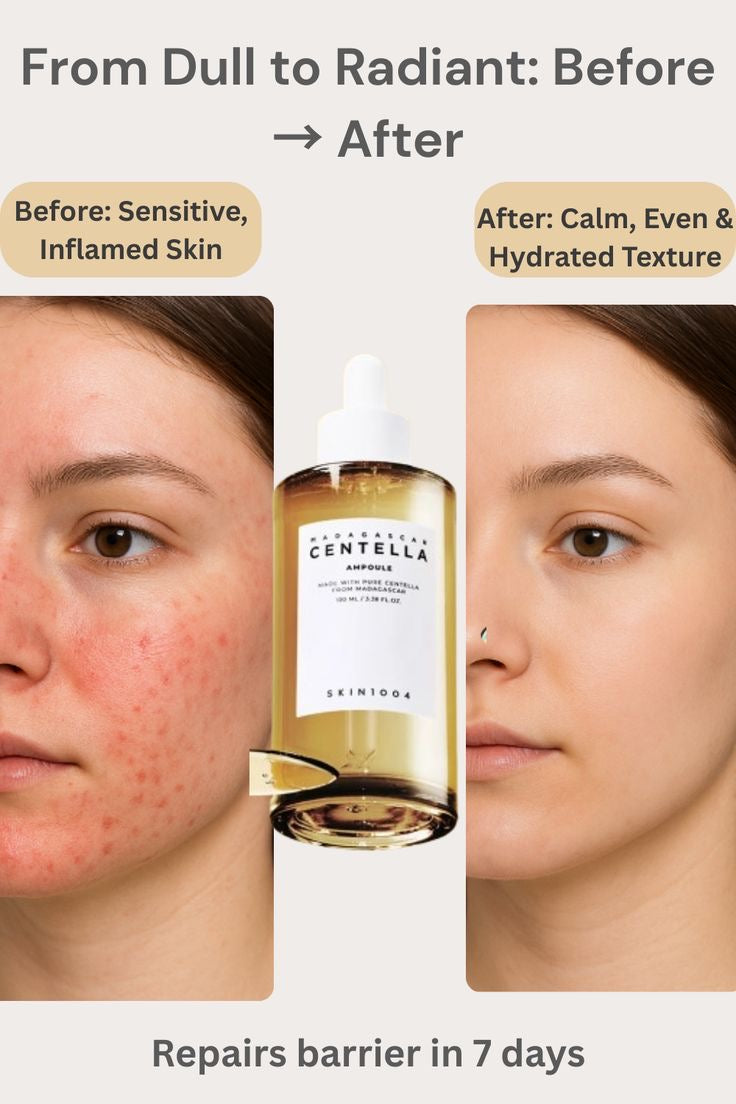 Skin 1004 Centella Ampoule