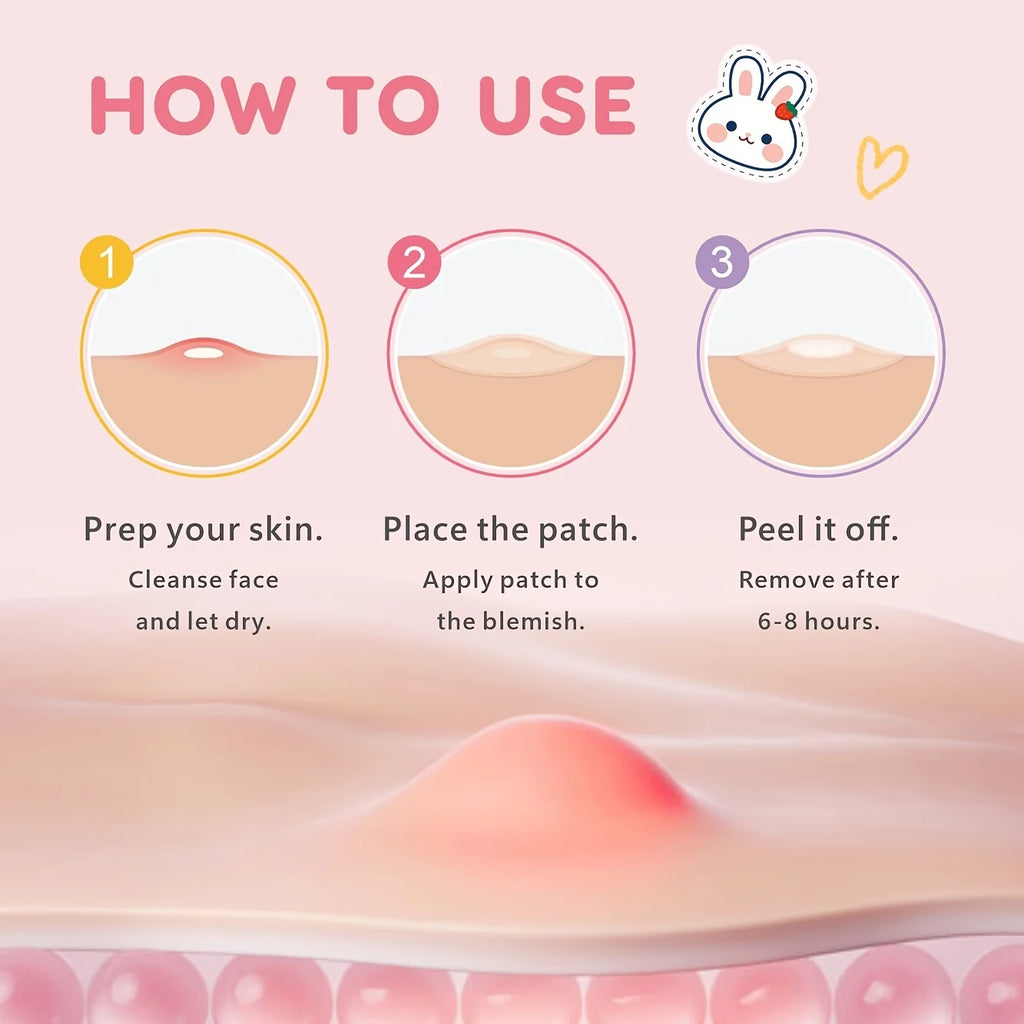 72/216PCS cute little rabbit cartoon acne stickers, gentle and non-irritating, covering acne and blemishes, as a photo accessory